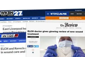 Media coverage