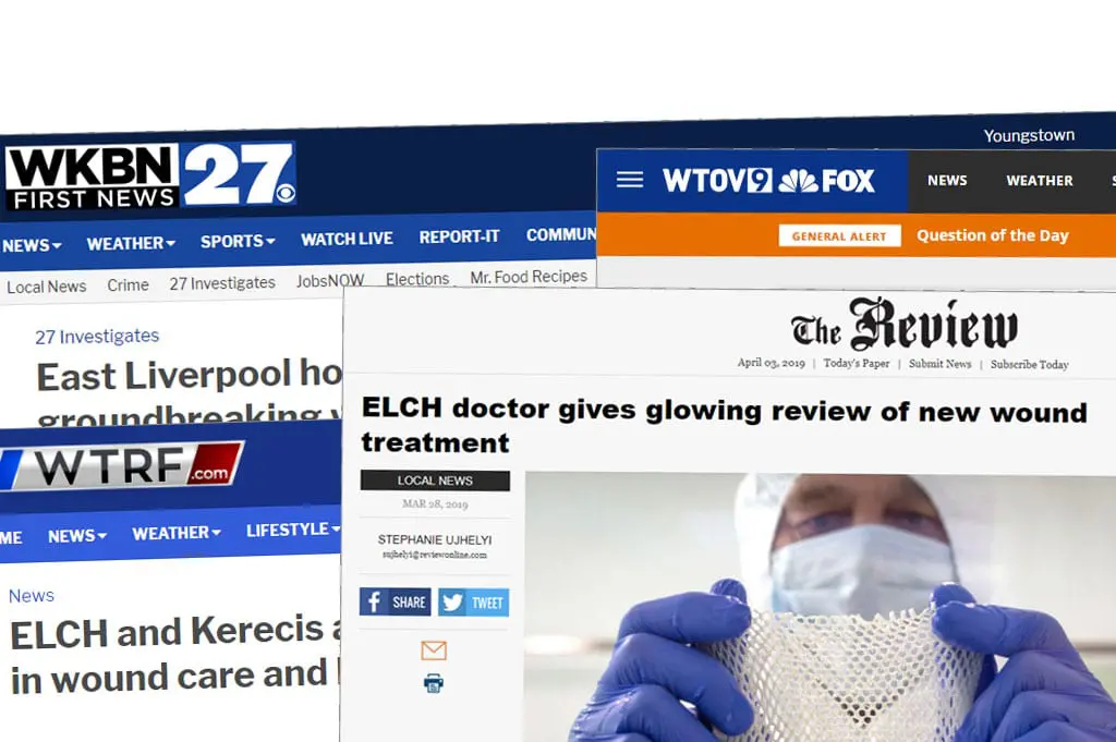 Media coverage