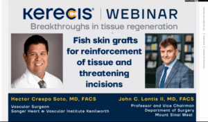 Breakthroughs-in-Tissue-Regeneration