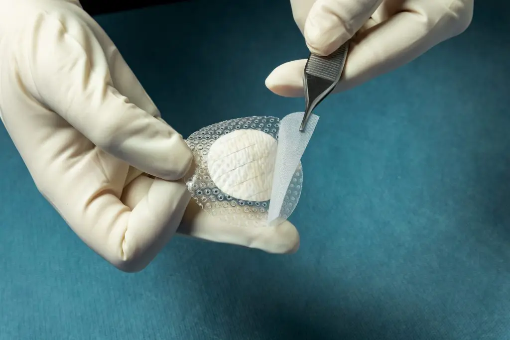 Kerecis MariGen® Shield