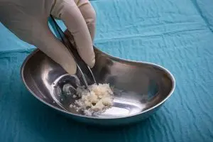 Micro