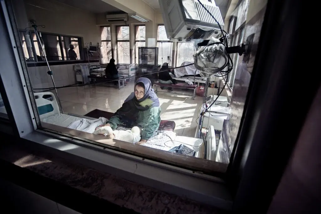 Burn-unit-in-Indira-Ghandi-childrens-hospital-in-Afghanistan-2019-02