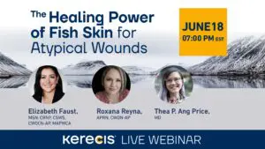 The Healing Power of Fish Skin for Atypical Wounds