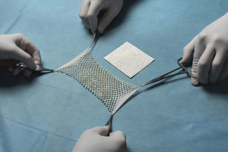 CMS Delays Skin Substitute Policy, Intact Fish-Skin Grafts Remain Covered on Existing LCDs