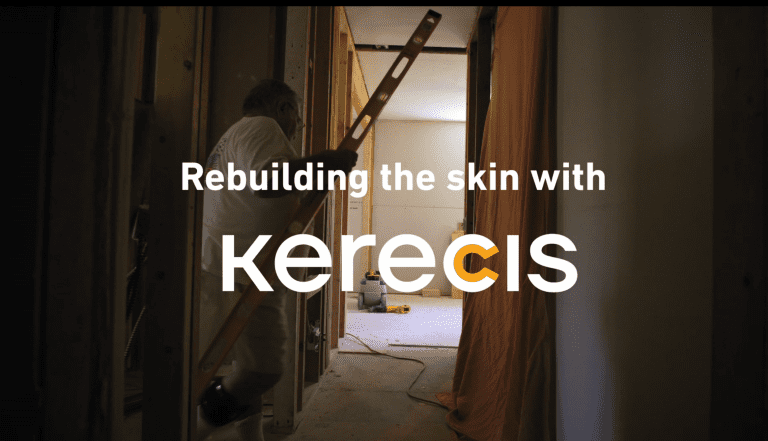 Rebuilding the skin with Kerecis