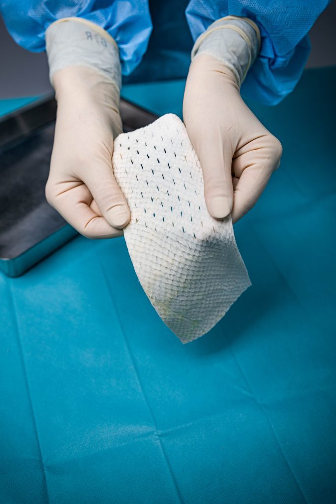 Kerecis product